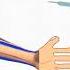 HOW TO USE ADRENALINE EPINEPHRINE IN ANAPHYLAXIS Pediatrics Medicine Epinephrine