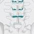 How Back Surgery Spinal Fusion Is Performed Spire Healthcare