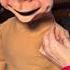 Puppet Surgery