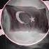 DOMBRA TRAP REMİX 2021