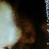 Fraunhofer Diffraction Bloodlust DEΛDLYDΛUGHTERS Remix