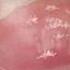Most Common Toenail Problems Home Treatment Guide