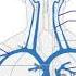 PICC V MIDLINE