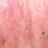 Some Video Worthy Blackheads On The Face Wouldn T You Say