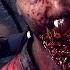 All Mortal Kombat X Fatalities And X Rays RAW
