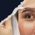 Hair And Eyebrow Transplant For Women Esteticium