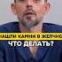 НАШЛИ КАМНИ В ЖЕЛЧНОМ ЧТО ДЕЛАТЬ желчныйпузырь желчь желчный здоровье доктор жкт камни