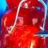 Emergency FruitSurgery Worlds Largest Gummy Bear Has 36 Babies DiscountDentist FoodSurgery