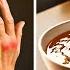 GOODBYE Swelling 8 Collagen Rich Foods You MUST Eat For Your LEGS And JOINTS Senior Health Tips