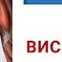 ВИСЦЕРАЛКА