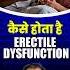 Erectiledysfunction