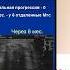 Возможности локальной гипертермической деструкции в лечении ЗНО различной локализации