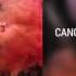 Canon I M Back Official Audio