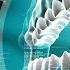Выращивание новых ЗУБОВ Восстановление зубного ряда восстановление зубов