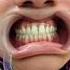 Rashid Dental Clinic Scaling Polishing Bleaching Extraction Denture Compositefilling Crown