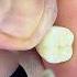 Music Song Love Hit Musik виниры Dentist Orthodontist Smiledesigndental Beautiful Smile