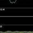 Undertale OST 051 Another Medium Deconstruction