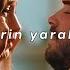 Derin Yaralar Slowed