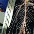 Real Nervous System Anatomy Human Body