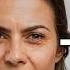 LOOK YOUNGER AGAIN Face Fat