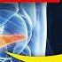ЦЕ перші ознаки ПРОБЛЕМ з підшлунковою Симптоми та ПРАВИЛЬНЕ лікування