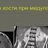 Желудкова Ольга Григорьевна Опухоли центральной нервной системы у детей