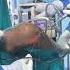 Laparoscopic Gall Bladder Stone Surgery Neet Shorts Mbbs