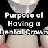 What Does A Dental Crown Do