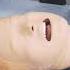 Airway Suctioning Skill