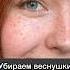 С веснушками или без