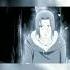 последние слова Итачи Shorts Naruto Narutoshippuden Sasuke Itachi Edit