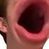 Kirby Inhales