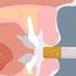 Why Give Up Smoking