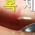 A Really AMAZING Eyelid Squeeze