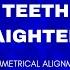 Teeth Straightening Treatment Symmetrical Alignment Morphic Energy Programmed