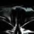 Angerfist Master