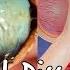 What S Inside An Eyeball Eyeball Dissection We The Curious
