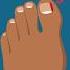 Causes Of Those Painful Ingrown Toenails Ouch