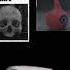 Scp Troll Face Edit