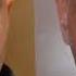 Natural Results In Rhinoplasty Beverly Hills Profiles