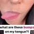 Bumps On Your Tongue Shorts