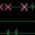 AVM Eps 16 Note Block Green S Jam Music By NeedInBalance Chart Only Rhythm Doctor Editor