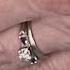 Crash Survivor Hopes Hospital Finds Missing Heirloom Ring