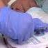 Using Wound Drainage Systems