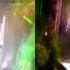 Melissa Dr Alban Habibi Live 3D