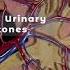 UTI In Men And Its Causes