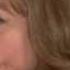 Normal And Abnormal Eye Movements