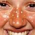 ASMR Mushroom Decomposes You Fungal Spa Facial Layered Sounds