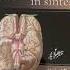 Neuroanatomia Netter Youtube Youtuber Shorts Neuroanatomia Netter Anatomia Anatomy Medicine