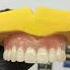 Rashid Dental Clinic Denture Scaling Polishing Bleaching Braces Orthodontist Scaling Crown